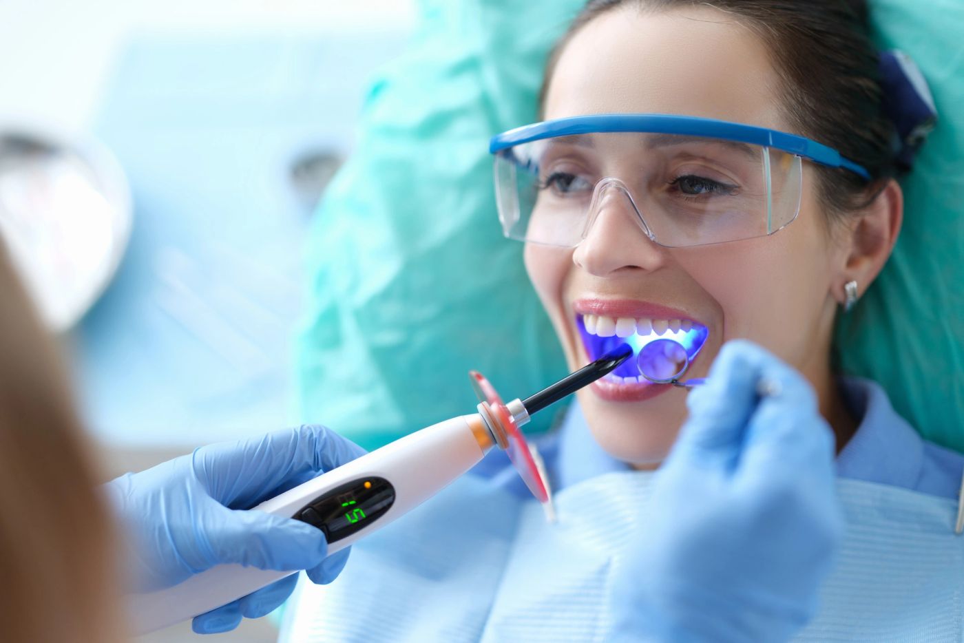 Dental Bonding in Tysons Corner, VA